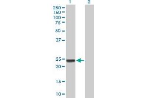 Western Blot analysis of ARHGDIA expression in transfected 293T cell line by ARHGDIA MaxPab polyclonal antibody. (ARHGDIA anticorps  (AA 1-204))