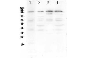 Western blot analysis of EPS15 using anti-EPS15 antibody . (EPS15 anticorps  (AA 2-88))