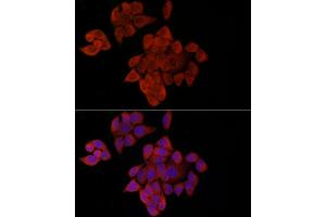 Immunofluorescence analysis of HeLa cells using OP antibody (ABIN6129426, ABIN6145031, ABIN6145032 and ABIN6225150) at dilution of 1:100 (40x lens). (OPA1 anticorps  (AA 661-960))