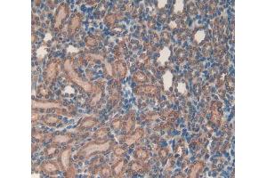 Used in DAB staining on fromalin fixed paraffin- embedded kidney tissue