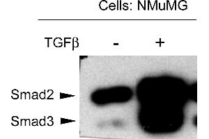 NMuMG mouse mammary epithelial cells were probed for the activation of Smad3 by detecting phosphorylation of threonine 179. (SMAD3 anticorps  (Internal Region, pThr179))