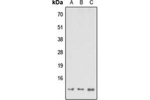 Western blot analysis of MP68 expression in HEK293T (A), Raw264. (C14orf2 anticorps  (Center))