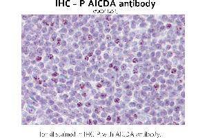 Image no. 1 for anti-Activation-Induced Cytidine Deaminase (AICDA) (N-Term) antibody (ABIN347161)