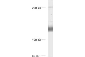 dilution: 1 : 1000, sample: rat brain homogenate (mGluR1 alpha anticorps  (AA 1092-1199))