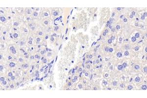 Detection of OGN in Mouse Liver Tissue using Polyclonal Antibody to Osteoglycin (OGN) (OGN anticorps  (AA 180-298))