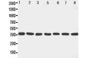 Western Blotting (WB) image for anti-Mitogen-Activated Protein Kinase Kinase 6 (MAP2K6) (AA 7-23), (N-Term) antibody (ABIN3042996) (MAP2K6 anticorps  (N-Term))
