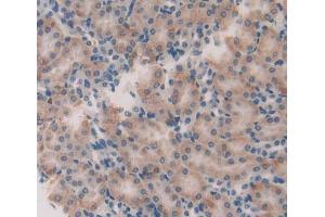 Used in DAB staining on fromalin fixed paraffin- embedded Kidney tissue