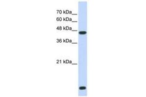 Image no. 1 for anti-Histone Deacetylase 8 (HDAC8) (N-Term) antibody (ABIN6742492) (HDAC8 anticorps  (N-Term))