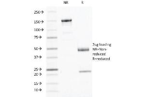 SDS-PAGE Analysis Purified Interferon gamma Mouse Monoclonal Antibody (IFNG/466). (Interferon gamma anticorps)