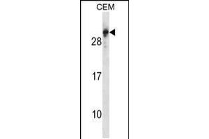 Western blot analysis in CEM cell line lysates (35ug/lane). (RGS5 anticorps  (N-Term))