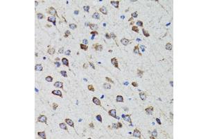 Immunohistochemistry of paraffin-embedded rat brain using HEXA antibody (ABIN6127519, ABIN6141730, ABIN6141732 and ABIN6216071) at dilution of 1:100 (40x lens). (Hexosaminidase A anticorps  (AA 270-529))