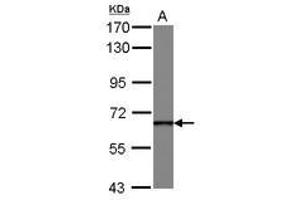 Image no. 1 for anti-DEAD (Asp-Glu-Ala-Asp) Box Polypeptide 49 (DDX49) (AA 66-318) antibody (ABIN1497806) (DDX49 anticorps  (AA 66-318))