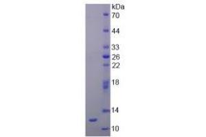SDS-PAGE analysis of Rat Renin Protein.