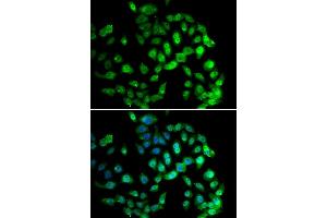 Immunofluorescence analysis of U20S cell using GPS1 antibody. (GPS1 anticorps)