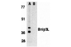 Western Blotting (WB) image for anti-BCL2/adenovirus E1B 19kDa Interacting Protein 3-Like (BNIP3L) antibody (ABIN1031701) (BNIP3L/NIX anticorps)