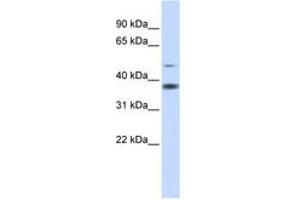 Image no. 1 for anti-Methylmalonic Aciduria (Cobalamin Deficiency) CblD Type, with Homocystinuria (MMADHC) (AA 216-265) antibody (ABIN6741309) (MMADHC anticorps  (AA 216-265))