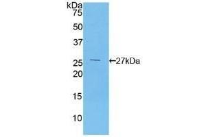 Detection of Recombinant F12, Human using Polyclonal Antibody to Coagulation Factor XII (F12) (F12 anticorps  (AA 400-615))
