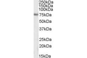 Image no. 1 for anti-Inositol-Trisphosphate 3-Kinase C (ITPKC) (AA 105-119) antibody (ABIN490480) (ITPKC anticorps  (AA 105-119))