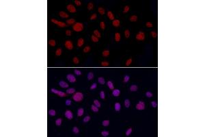 Immunofluorescence analysis of U2OS cells using YE Rabbit pAb (ABIN6130808, ABIN6150331, ABIN6150332 and ABIN6221925) at dilution of 1:50 (40x lens). (GAS41 anticorps  (AA 1-227))