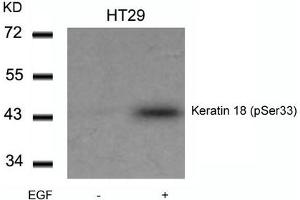 Western blot analysis of extracts from HT29 cells untreated or treated with EGF using Keratin 18(Phospho-Ser33) Antibody.