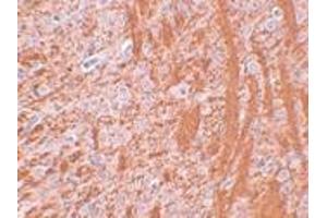 Immunohistochemistry (IHC) image for anti-Jumonji Domain Containing 6 (JMJD6) (N-Term) antibody (ABIN1031427) (JMJD6 anticorps  (N-Term))