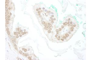 Immunohistochemistry (IHC) image for anti-BTB (POZ) Domain Containing 12 (BTBD12) (AA 1784-1834) antibody (ABIN7448447)