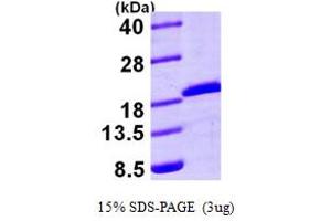 SDS-PAGE (SDS) image for Ubiquitin-Conjugating Enzyme E2A (ube2a) (AA 1-152) protein (His tag) (ABIN666994) (UBE2A Protein (AA 1-152) (His tag))