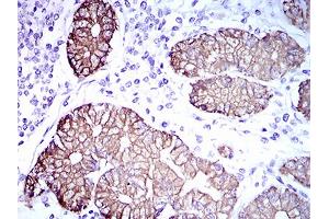 Immunohistochemical analysis of paraffin-embedded stomach tissues using CK5 mouse mAb with DAB staining. (Cytokeratin 5 anticorps  (AA 316-590))