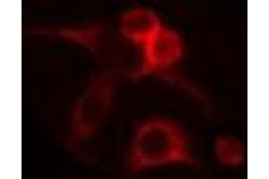 ABIN6275277 staining RAW264. (CYB5R1 anticorps  (C-Term))