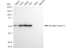 Western blotting analysis using estrogen receptor 2 antibody (ABIN7798494). (Recombinant ESR2 anticorps)