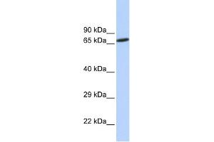 WB Suggested Anti-ZNF571 Antibody Titration:  0. (ZNF571 anticorps  (N-Term))