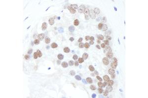 Immunohistochemistry (IHC) image for anti-X-Ray Repair Complementing Defective Repair in Chinese Hamster Cells 1 (XRCC1) (pSer518), (pThr519) antibody (ABIN7449376)