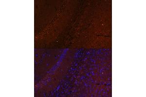 Immunofluorescence analysis of mouse brain using RUSC1 antibody (ABIN7270114) at dilution of 1:100. (RUSC1 anticorps  (AA 1-320))