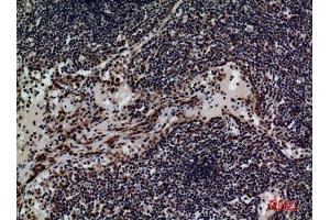 Immunohistochemistry (IHC) analysis of paraffin-embedded Human Lymph, antibody was diluted at 1:100.