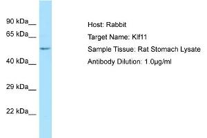 WB Suggested Anti-Klf11 Antibody   Titration: 1. (KLF11 anticorps  (N-Term))