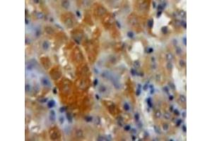 Used in DAB staining on fromalin fixed paraffin-embedded Kidney tissue (TGFB3 anticorps  (AA 274-372))