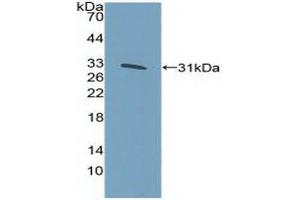 Figure. (KLF5 anticorps  (AA 216-457))