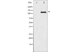 Western blot analysis of JAK2 expression in K562 whole cell lysates,The lane on the left is treated with the antigen-specific peptide. (JAK2 anticorps  (N-Term))