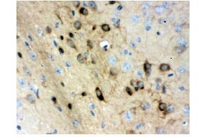 IHC analysis of Stathmin 1 using anti-Stathmin 1 antibody (ABIN3043301). (Stathmin 1 anticorps  (N-Term))