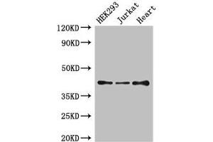 Western Blot Positive WB detected in: HEK293 whole cell lysate, Jurkat whole cell lysate, Mouse heart tissue All lanes: S1PR5 antibody at 4 μg/mL Secondary Goat polyclonal to rabbit IgG at 1/50000 dilution Predicted band size: 42, 33 kDa Observed band size: 42 kDa (S1PR5 anticorps  (AA 309-398))