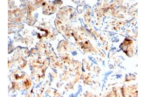 Formalin-fixed, paraffin-embedded human Placenta stained with S100A4 Recombinant Mouse Monoclonal Antibody (rS100A4/1481).