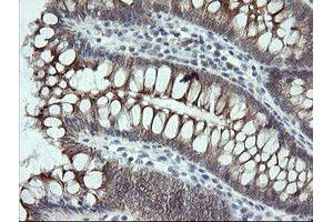 Image no. 4 for anti-Prefoldin Subunit 3 (PFDN3) antibody (ABIN1501702)