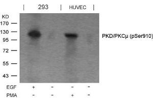 Western blot analysis of extracts from EGF-treated 293 and PMA-treated HUVEC cells using PKD/PKCm(Phospho-Ser910) Antibody.