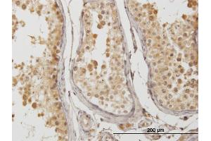 Immunoperoxidase of monoclonal antibody to ATP6V1D on formalin-fixed paraffin-embedded human testis.