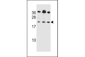 Bak antibody western blot analysis in 1) Jurkat, 2) MDA-MB453 and 3) 293 lysate