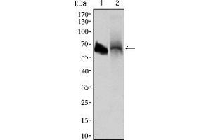 Western blot analysis using ALPI mouse mAb against HL60 (1) and HepG2 (2) cell lysate. (Intestinal Alkaline Phosphatase anticorps  (AA 397-458))