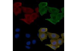 ABIN6257995 and ABIN6275571 staining Hela cells(30 min of UV treatment) by IF/ICC.