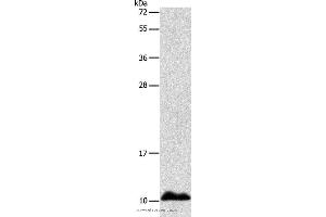 Western blot analysis of Human fetal liver tissue, using APOC1 Polyclonal Antibody at dilution of 1:500 (APOC1 anticorps)