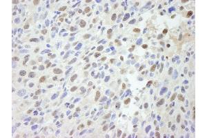 Immunohistochemistry (IHC) image for anti-Mediator Complex Subunit 12 (MED12) (C-Term) antibody (ABIN7448660) (MED12 anticorps  (C-Term))