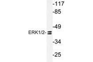 Western blot analyzes of ERK1/2 antibody in extracts from HUVEC cells. (ERK1 anticorps)